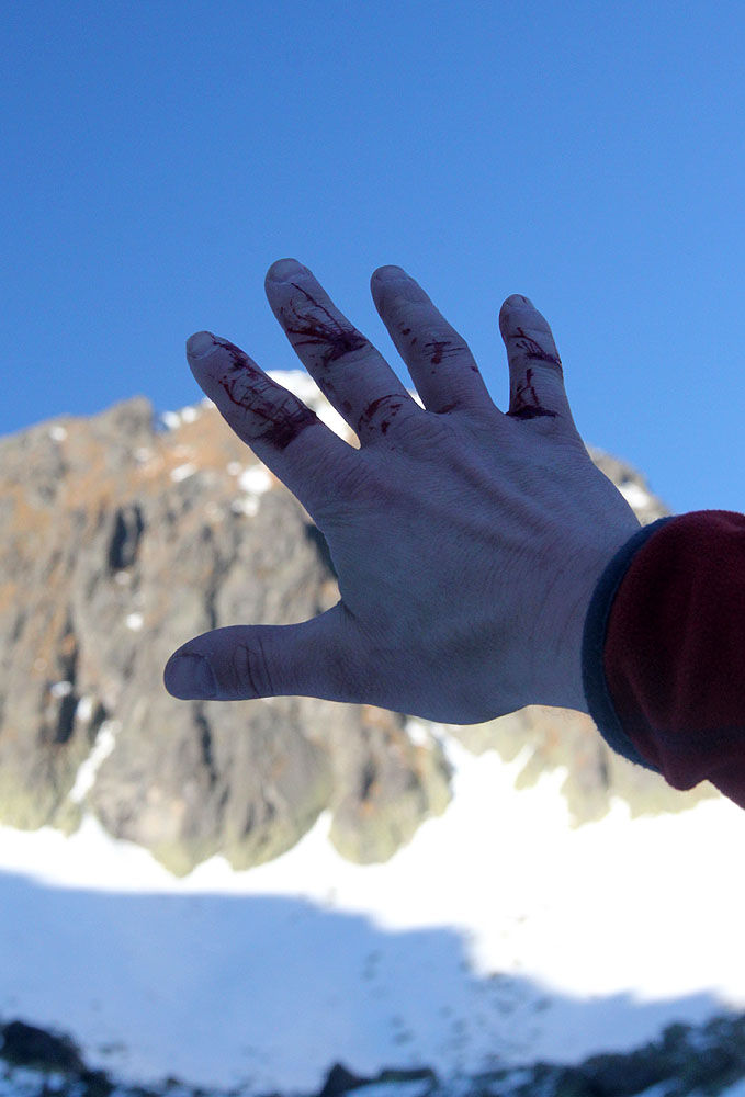 Když už chci padat při sjezdu, tak si příště asi vezmu rukavice